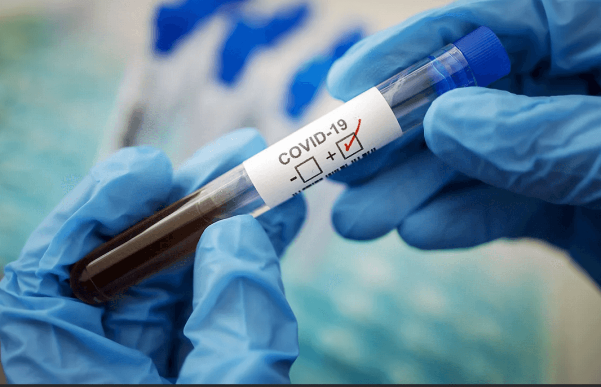 Бір тәулікте 93 адамнан коронавирус инфекциясы анықталды